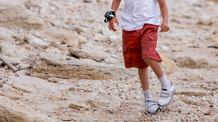 boy walking with bowlegged legs.