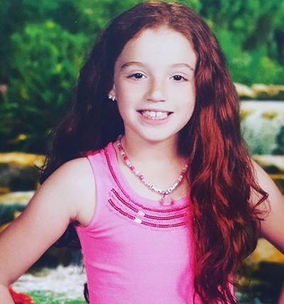 Melany antes de someterse al tratamiento